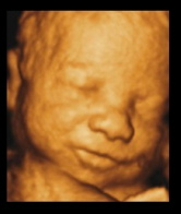 Ultrasound Image
